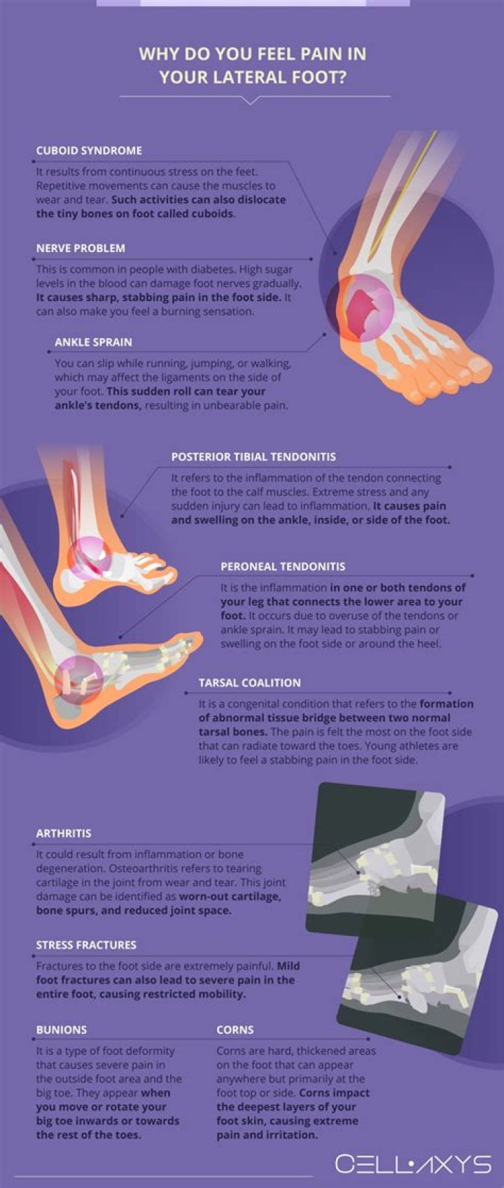 Understanding the Causes and Solutions for Left Side Foot Pain from Hoka Shoes